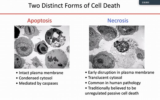 RIPK1, Cell death and human disease. (ISAR 3rd, Prof, JY Y)
