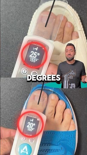 The Best Shoes For Toe Alignment