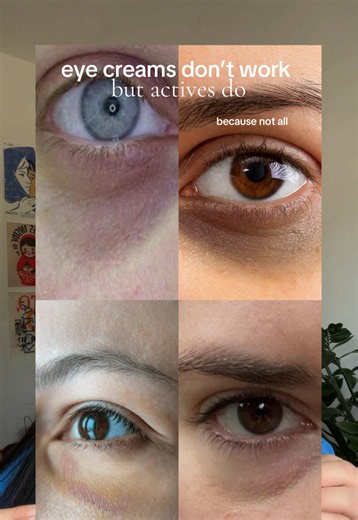 Eye Creams Don't Work? Here's What Actually Fixes Under-Eyes