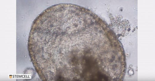 ヒト気道 in vitro 3Dモデル 肺オルガノイドの3次元培養「PneumaCult-ALI」｜ラーニングコーナー | ベリタス