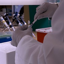 Video: In Vivo Gene Delivery into Mouse Mammary Epithelial Cells Through Mammary Intraductal Injection