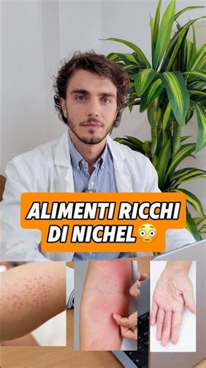 Nickel intolerance: here are the foods that contain the most (and what to do)