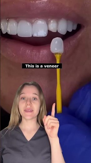 What is the difference between veneers and crowns?