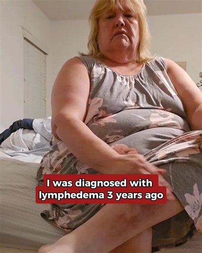 1.8K views · 19 reactions |  Tired, swollen legs after a long day? These easy-to-wear compression wraps bring relief in minutes. ✅ Fits wide calves (up to 35") comfortably ✅ Discreet under clothing ✅ Relieves swelling & heaviness fast ✅ Adjustable pressure for all-day comfort Join thousands finding relief and energy again with Beltwell™ wraps. ⚡ Save 60% today — before the sale ends!  Tap Shop Now to get yours. | Beltwell | Facebook