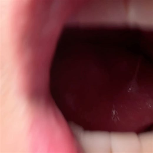 Scott Hoying on Reels