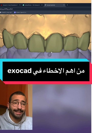 من اهم الاخطاء اللي بتحصل في الحالات الاماميه في اكزوكاد Anteriors in exocad #exocad #اسنان #طب_اسنان #تركيبات_الاسنان #dryousef_shaaban