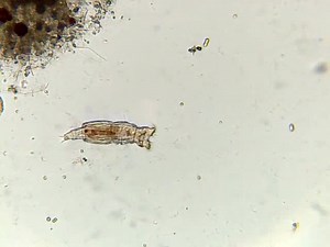 In the late 1600s, Dutch cloth merchant and self-taught scientist Antonie van Leeuwenhoek made groundbreaking discoveries using his handcrafted microscopes. He became the first person to observe microscopic organisms he affectionately called "animalcules." Most fascinating among these were rotifers—tiny aquatic animals with wheel-like feeding appendages—which he began studying extensively in 1687. Unlike other microorganisms that disintegrated when dried out, van Leeuwenhoek observed that rotife