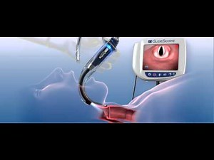 GlideScope AVL Demonstration