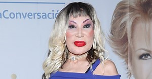¿Qué se hizo Lyn May en el rostro?
