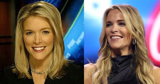Megyn Kelly’s Plastic Surgery Rumors Just Got Worse – Expert Says Her ‘Wonky Nostrils’ Are the Result of a ‘Terrible Rhinoplasty’