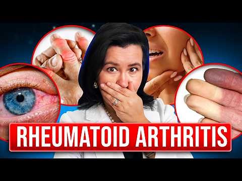 8 DEADLY Signs of Rheumatoid Arthritis
