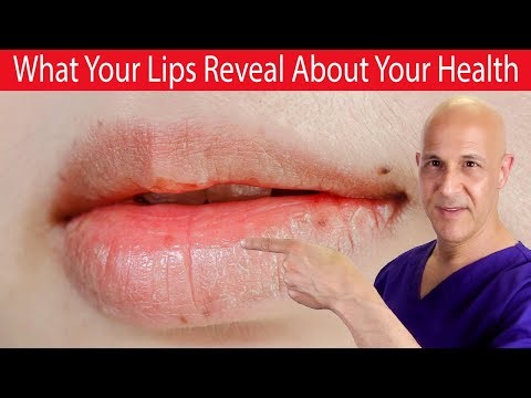 15 Surprising Ways What Your LIPS Can Tell You About Your Health! Dr. Mandell