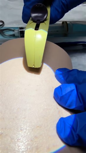 Sarah Pringle on Instagram: "Birth control"