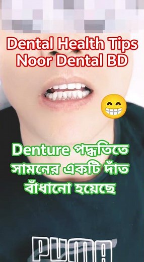 Denture method for front teeth @DentalHealthTips
