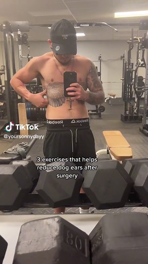 Reducing Dog Ears After Mastectomy: Tips and Exercises