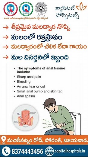 Understanding Anal Fissures | Causes, Symptoms & Treatment