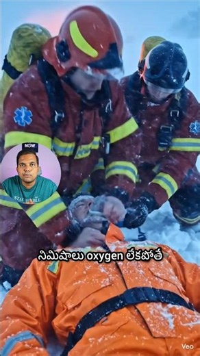 He Was DEAD for 18 Minutes... Then THIS Happened! 🥶 #facts #telugushorts