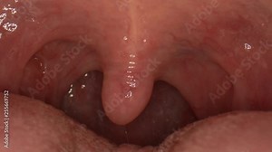 Macro close-up of the inside of a human mouth as the uvula dangles and moves around