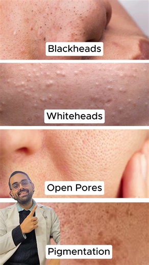 ✨ Dermatologist's Pharmacy Skincare Guide #PharmacySkincare #Dermatologist #Skincare #HealthySkin