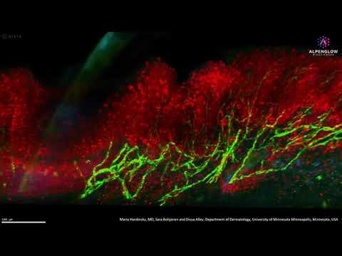 Mapping Epidermal Innervation Patterns in the Scalp with 3D Imaging
