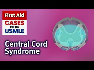 USMLE First Aid - Central Cord Syndrome, Anatomy/Pathophysiology/Signs/Symptoms, Watershed Zone