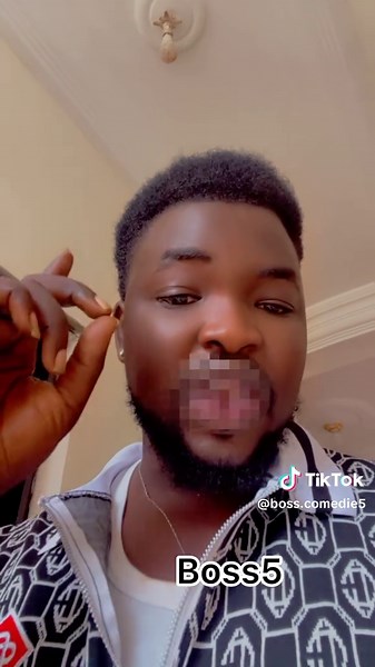 Abdou Comedian: Senegal vs RDC Comedy Show