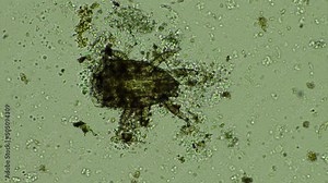 soil microorganisms including nematode, microarthropods, micro arthropod, tardigrade, and rotifers a soil sample, soil fungus and bacteria on a regenerative farm in compost under the microscope