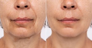 Rides profondes : cette nouvelle crème de nuit FILORGA les défroisse pour une peau lisse, ferme et rebondie à chaque réveil