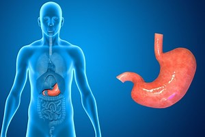 Functional dyspepsia: symptoms, tests and treatment