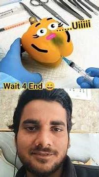 Yellow chilli surgery 😄. #animation #cartton #funny #comedyanimation #shorts