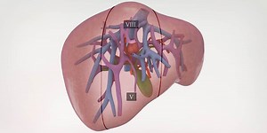 Laparoscopic right anterior sector resection - TVASurg - The Toronto Video Atlas of Surgery