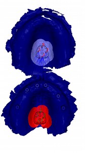 Dr. Allan Queiroz | The MOD Institute | 🚀 TISSUE TRACKER: THE SECRET TO FLAWLESS IMMEDIATE LOAD! (Edentulous Case) 🔥 Want total precision in prosthetic alignment after full-arch... | Instagram