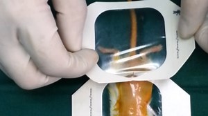 Comparing Metastatic Clear Cell Renal Cell Carcinoma Model Established in Mouse Kidney and on Chicken Chorioallantoic Membrane