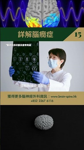 詳解腦癇症（十五）#腦癇 #癲癇 #腦神經 #神經科