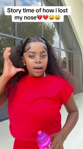 Story Time: How I Lost My Nose