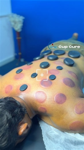 Hot Stone Therapy!# #viralreels #massage #hijama #relax #reels #viral #skincare #trendingreels
