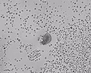 129K views · 316 reactions | In the medicine of the future, molecular...