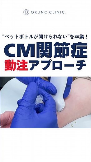 親指のつけ根が痛い…それ、CM関節症かもしれません Thumb base pain? It might be CMC joint arthritis