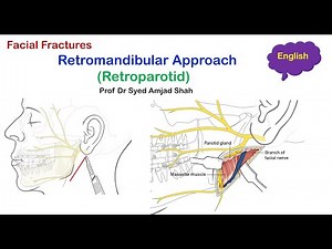 Retromandibular | Retroparotid approach | English | Oral & Maxillofacial Surgery | Syed Amjad Shah