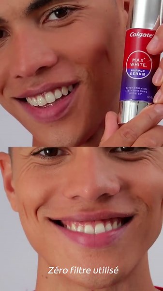 Envie d’un sourire éclatant en un instant* ? Ne cherche plus 😌 Découvre notre Purple Serum Colgate Max White : un booster de blancheur post-brossage qui neutralise instantanément* les tons jaunes et illumine ton sourire dès la première utilisation ✨ Disponible dès maintenant en ligne et en magasin ! *L’effet instantané est temporaire #Colgate #ColgateFrance #ColgateMaxWhite #dentsblanches #PurpleSerum