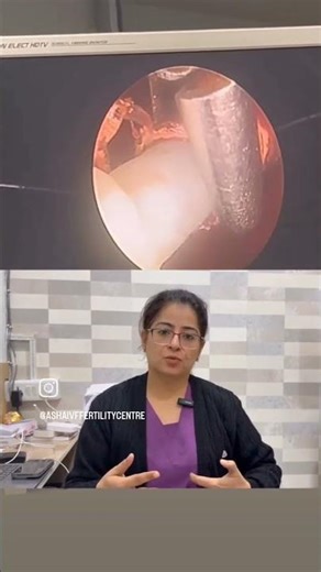 How to Care for Copper T? Removing a Stuck Copper T with Hysteroscopy | Asha IVF & Fertility centre