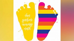 What is Down syndrome?