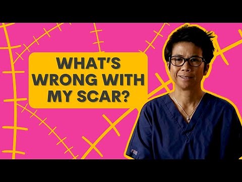 Understanding Scar Complications: Causes and Solutions - with Dr Tasha