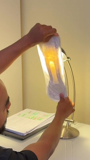 ¿Qué tienen por dentro las toallas higiénicas? #viralreelsシ | Dr. Esteban Contreras