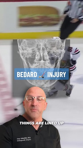 🏒 Bedard Jaw Fracture - Maxillofacial injuries are on the rise, and it's crucial that we understand the factors influencing these injuries for better prevention and treatment. The mandible (jaw bone), the only movable bone in the maxillofacial region, is particularly prone to fractures. Factors influencing the location of these fractures include age, health status, and external forces applied. Did you know that the mandible is more likely to fracture in males and those in their 20s? The most co