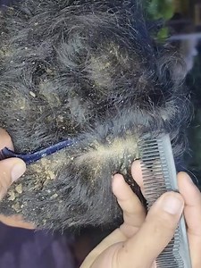 Dandruff clean so deeply soothing. | The Flake Doctor