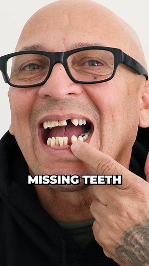 5.7K views · 32 reactions | The Thing About Tooth Loss That No One Will Tell You 﫢 #dentalimplants #ToothPain #boneloss #dentures #makeover | Nuvia Dental Implant Center | Facebook