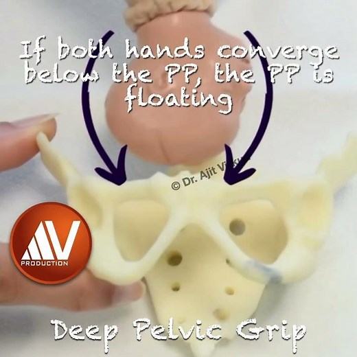 Fourth Leopald Manoeuvre Deep Pelvic Grip