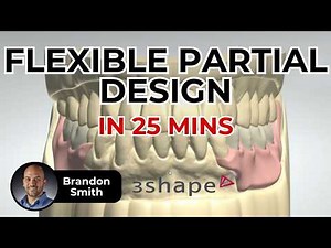 Efficient 3Shape Flexible Partial Design in 25 minutes - ep 0051