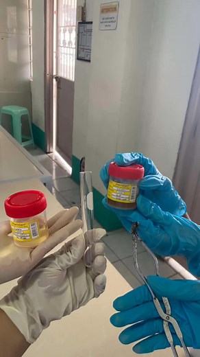 Benedict's Test 🧪 #fyp #biochemistry #labaratory #experiment